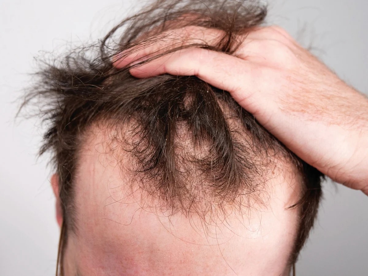 set rambut gugur shaklee