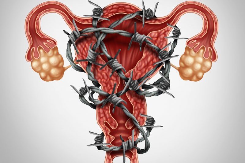 Urus Endometriosis Tanpa Derita: Strategi Pemakanan & Gaya Hidup Terkini