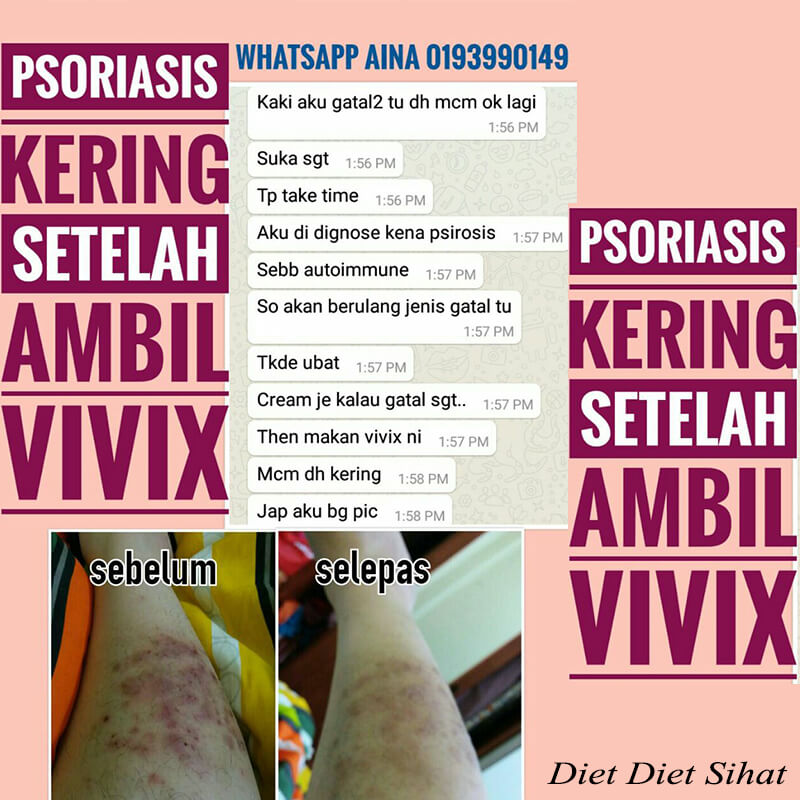 psoriasis kering setelah ambil vivix