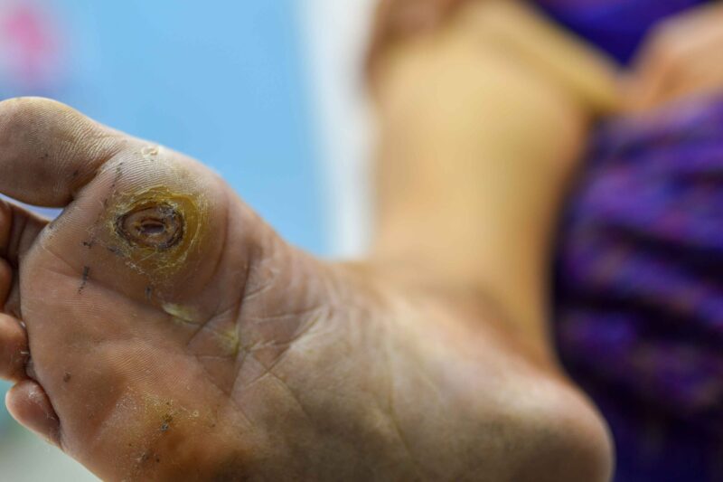 DIABETES & PREDIABETES: Mengambil Alih Kawalan Gula Darah dengan Kuasa Polifenol