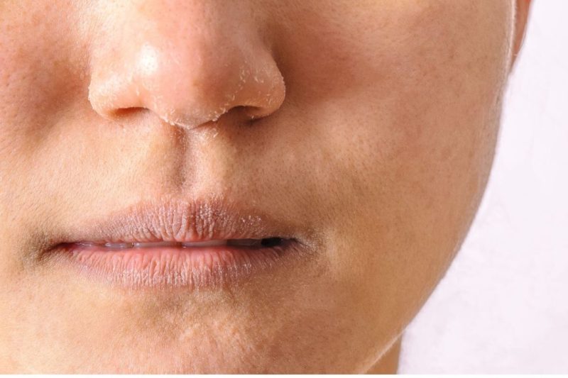 Kulit Kering Kedut Halus: Punca Wajah Nampak Tua & Rahsia Awet Muda Dengan Kuasa Polifenol