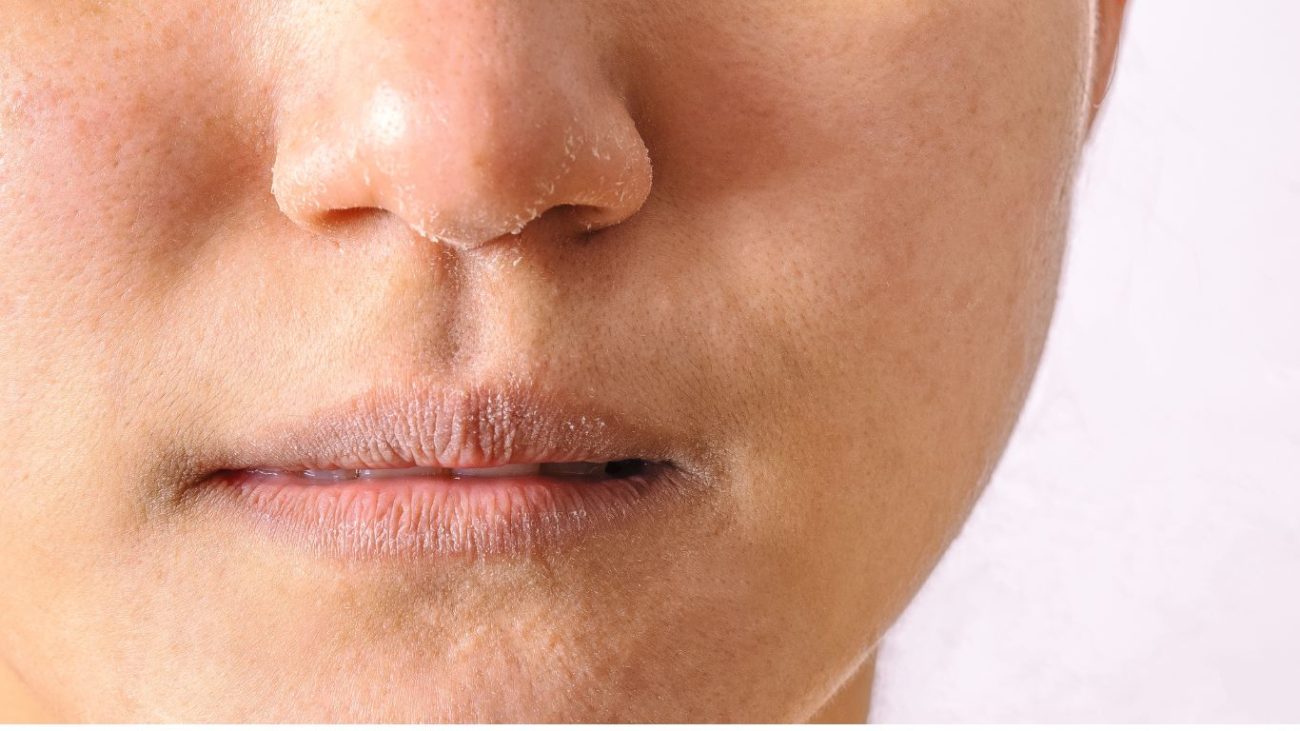 kulit kering kedut halus