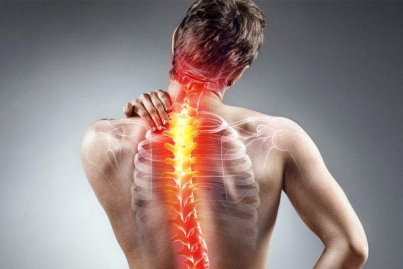 Sakit Tulang Belakang – Panduan Komprehensif  Dari ‘Slip Disc’ Hingga Kuasa Polifenol